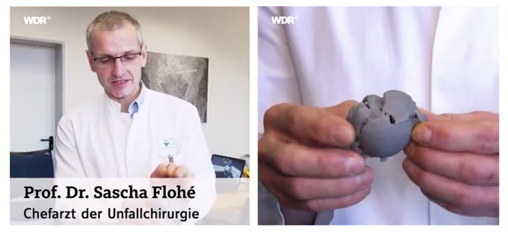 Dr. Sascha Flohé shown 3D printed bone models